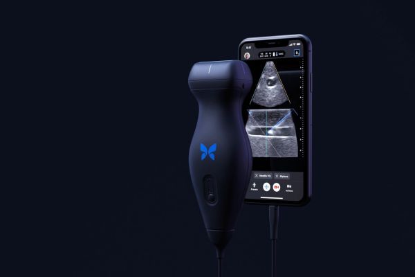 A butterfly probe scanner.